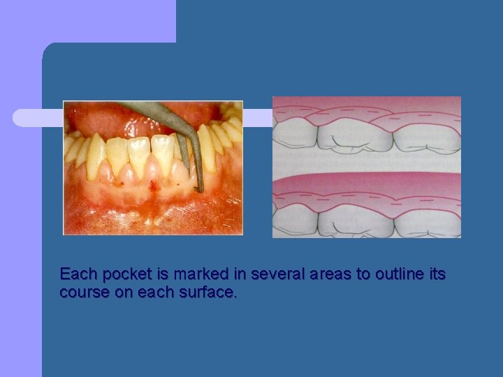 Each pocket is marked in several areas to outline its course on each surface. Each pocket is marked in several areas to outline its course on each surface.