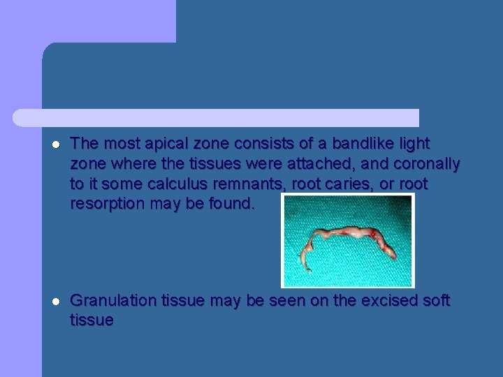 l The most apical zone consists of a bandlike light zone where the tissues l The most apical zone consists of a bandlike light zone where the tissues