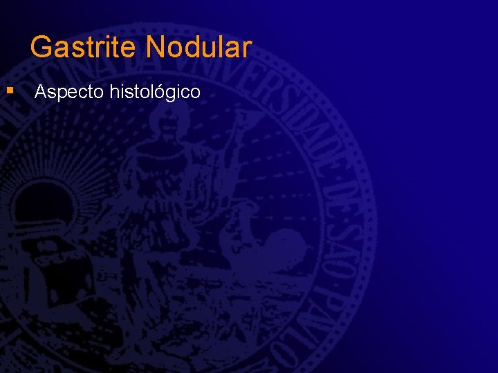 Gastrite Nodular § Aspecto histológico Gastrite Nodular § Aspecto histológico