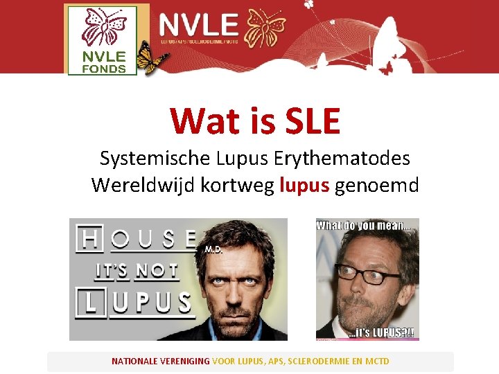 Wat is SLE Systemische Lupus Erythematodes Wereldwijd kortweg lupus genoemd NATIONALE VERENIGING VOOR LUPUS,