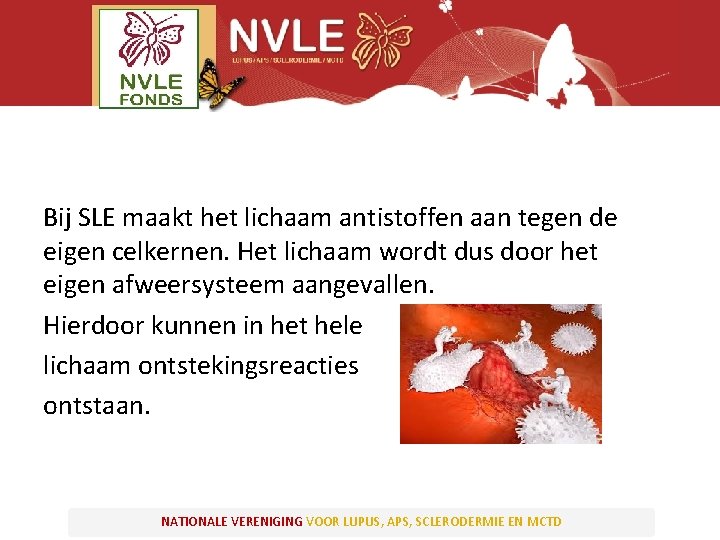 Bij SLE maakt het lichaam antistoffen aan tegen de eigen celkernen. Het lichaam wordt