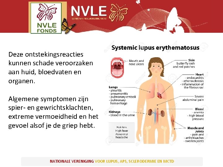 Deze ontstekingsreacties kunnen schade veroorzaken aan huid, bloedvaten en organen. Algemene symptomen zijn spier-