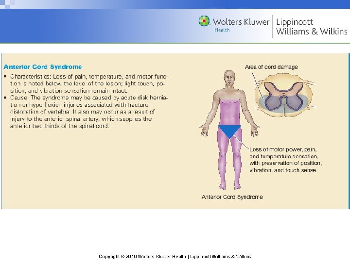 Copyright © 2010 Wolters Kluwer Health | Lippincott Williams & Wilkins Copyright © 2010 Wolters Kluwer Health | Lippincott Williams & Wilkins