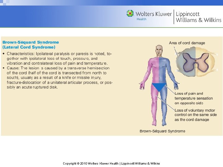 Copyright © 2010 Wolters Kluwer Health | Lippincott Williams & Wilkins Copyright © 2010 Wolters Kluwer Health | Lippincott Williams & Wilkins
