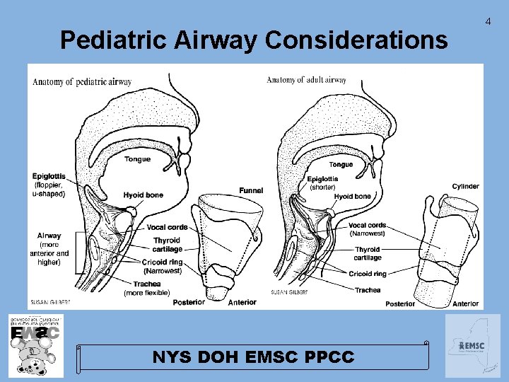 Pediatric Airway Considerations NYS DOH EMSC PPCC 4 Pediatric Airway Considerations NYS DOH EMSC PPCC 4