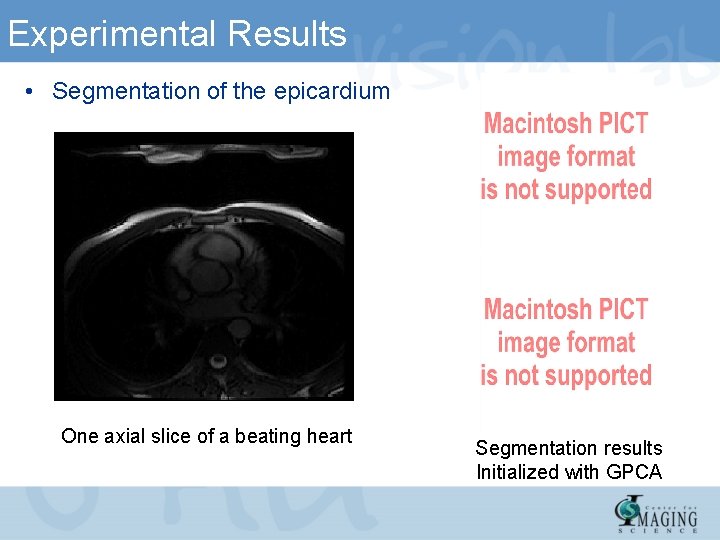 Experimental Results • Segmentation of the epicardium One axial slice of a beating heart