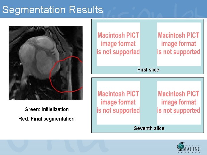 Segmentation Results First slice Green: Initialization Red: Final segmentation Seventh slice 