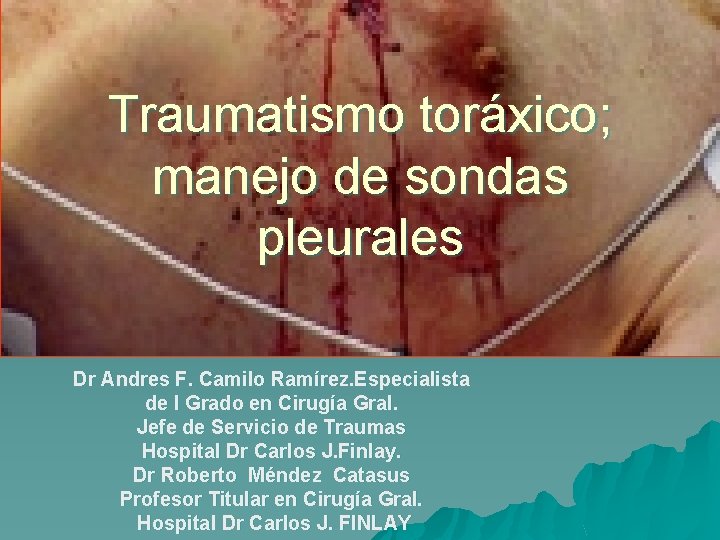 Traumatismo toráxico; manejo de sondas pleurales Dr Andres F. Camilo Ramírez. Especialista de I