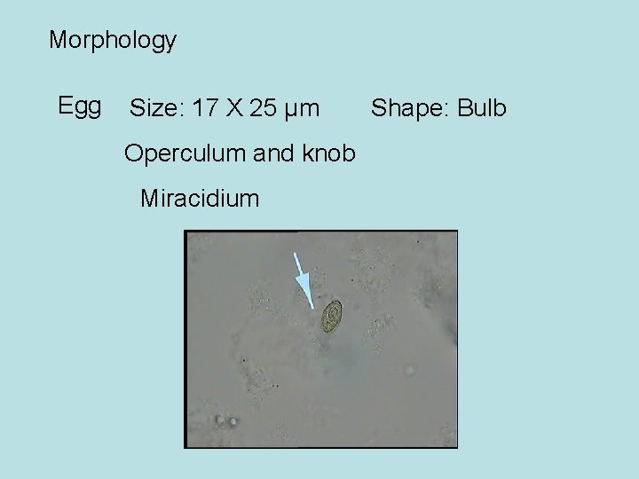 Morphology Egg Size: 17 X 25 µm Operculum and knob Miracidium Shape: Bulb 