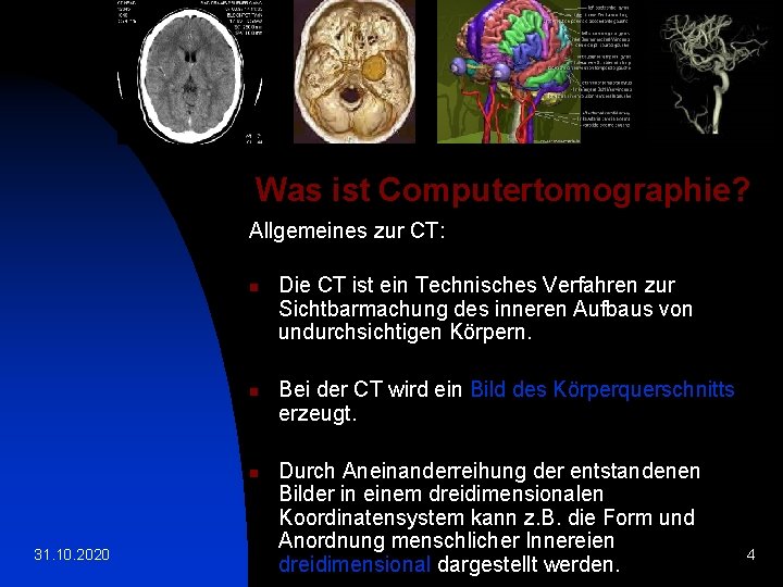 Was ist Computertomographie? Allgemeines zur CT: n n n 31. 10. 2020 Die CT
