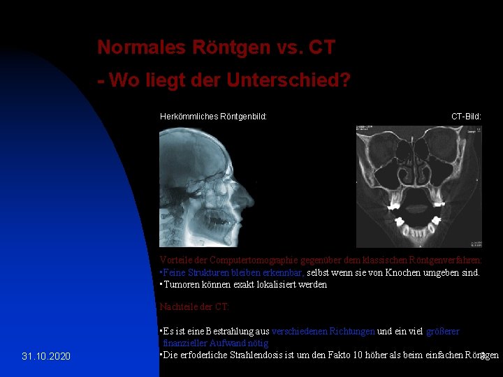 Normales Röntgen vs. CT - Wo liegt der Unterschied? Herkömmliches Röntgenbild: CT-Bild: Vorteile der