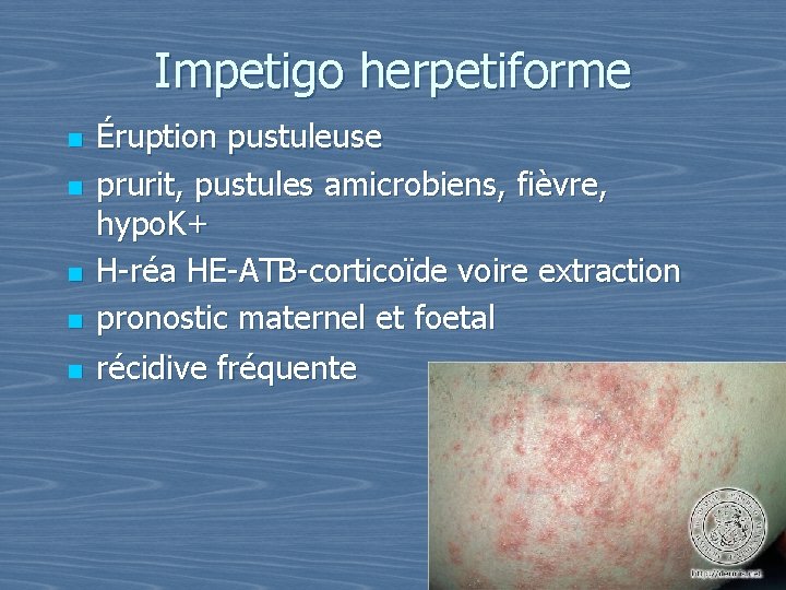 Impetigo herpetiforme n n n Éruption pustuleuse prurit, pustules amicrobiens, fièvre, hypo. K+ H-réa