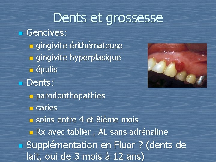 Dents et grossesse n Gencives: gingivite érithémateuse n gingivite hyperplasique n épulis n n