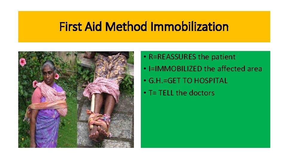 First Aid Method Immobilization IT R. G. H. T the patient • DO R=REASSURES