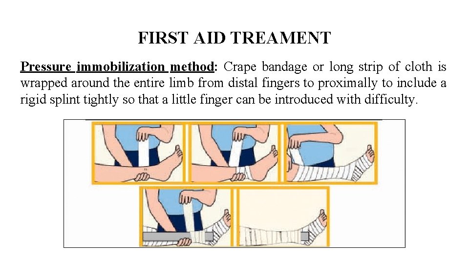 FIRST AID TREAMENT Pressure immobilization method: Crape bandage or long strip of cloth is