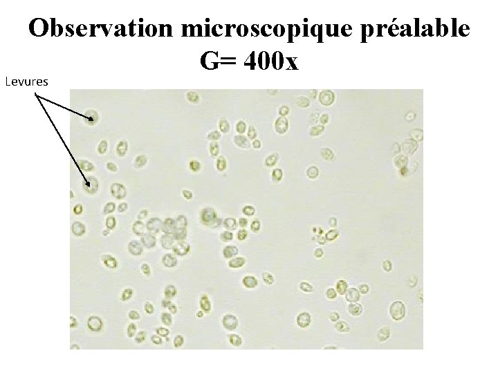 Observation microscopique préalable G= 400 x Levures 