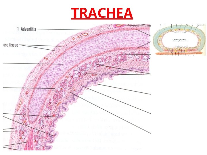 TRACHEA 