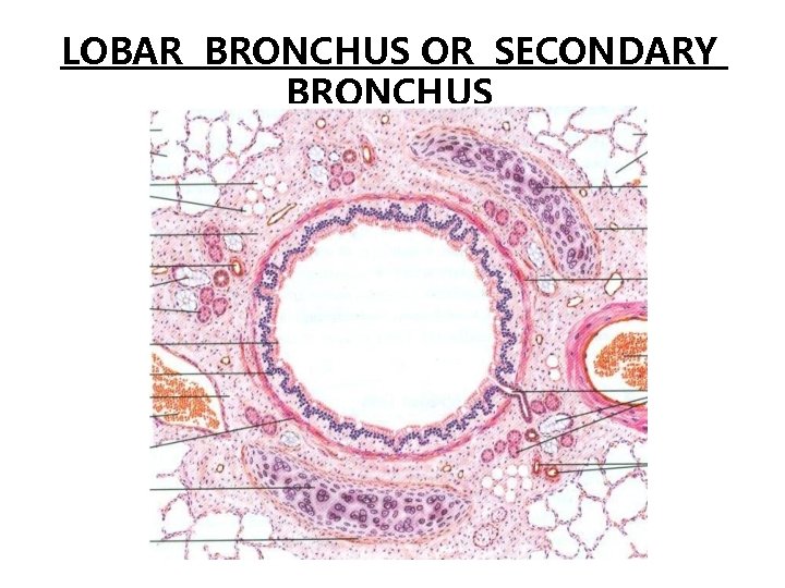 LOBAR BRONCHUS OR SECONDARY BRONCHUS 