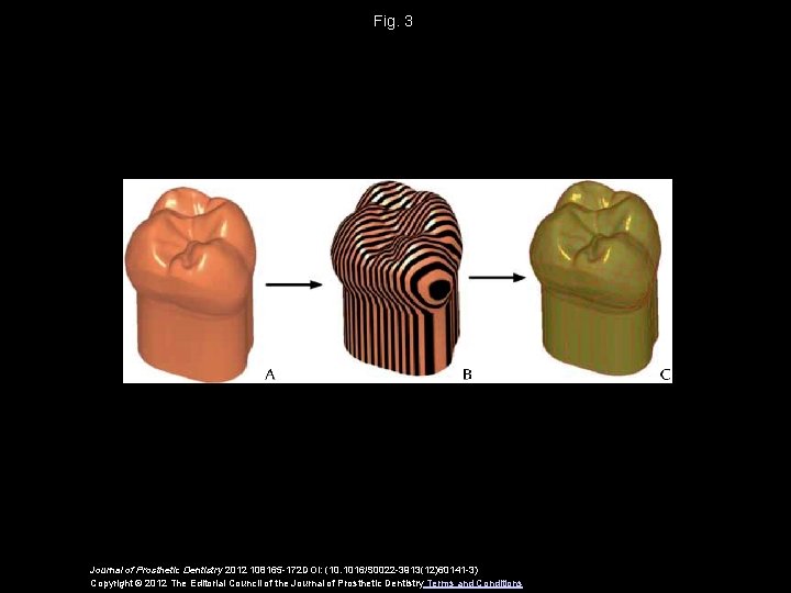 Fig. 3 Journal of Prosthetic Dentistry 2012 108165 -172 DOI: (10. 1016/S 0022 -3913(12)60141 Fig. 3 Journal of Prosthetic Dentistry 2012 108165 -172 DOI: (10. 1016/S 0022 -3913(12)60141