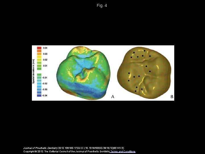 Fig. 4 Journal of Prosthetic Dentistry 2012 108165 -172 DOI: (10. 1016/S 0022 -3913(12)60141 Fig. 4 Journal of Prosthetic Dentistry 2012 108165 -172 DOI: (10. 1016/S 0022 -3913(12)60141