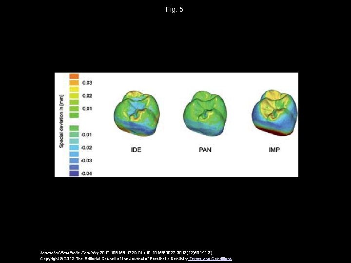 Fig. 5 Journal of Prosthetic Dentistry 2012 108165 -172 DOI: (10. 1016/S 0022 -3913(12)60141 Fig. 5 Journal of Prosthetic Dentistry 2012 108165 -172 DOI: (10. 1016/S 0022 -3913(12)60141
