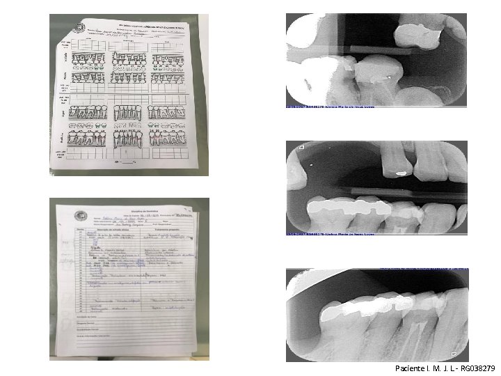 Paciente I. M. J. L. - RG 038279 