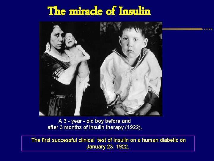 The miracle of Insulin A 3 - year - old boy before and after