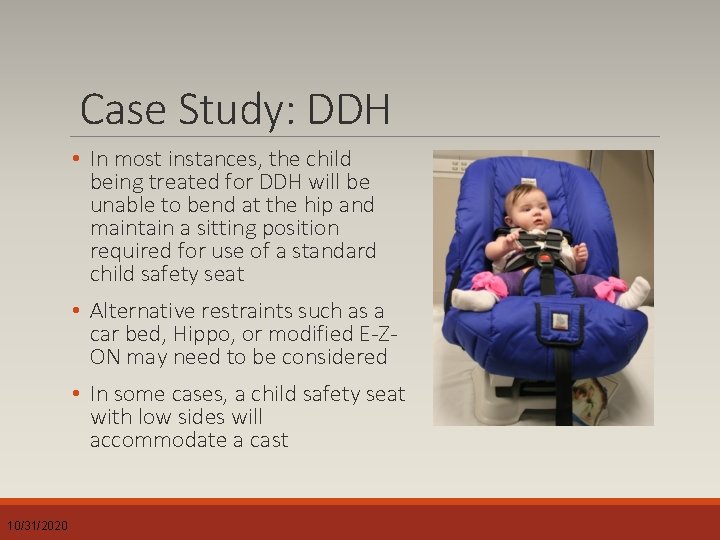 Case Study: DDH • In most instances, the child being treated for DDH will