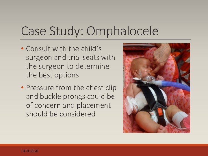 Case Study: Omphalocele • Consult with the child’s surgeon and trial seats with the