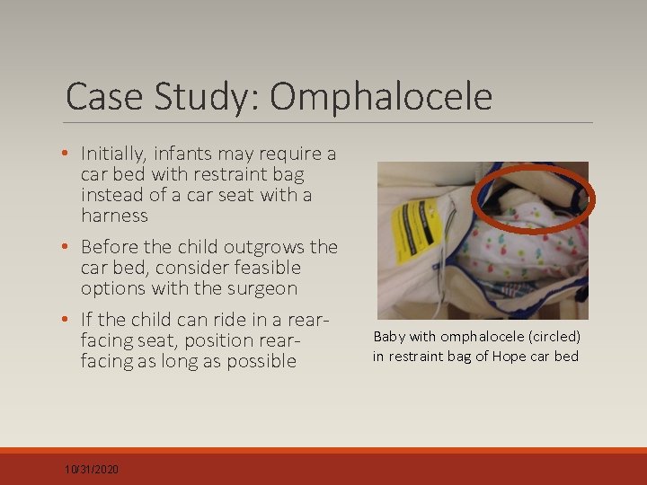 Case Study: Omphalocele • Initially, infants may require a car bed with restraint bag