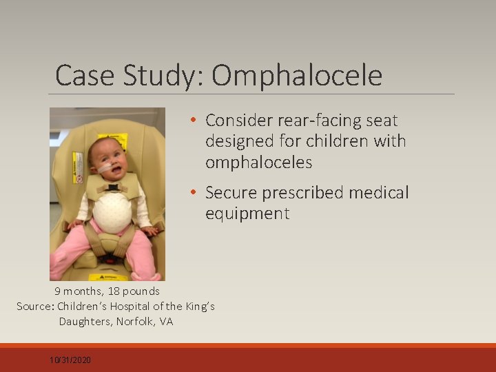 Case Study: Omphalocele • Consider rear-facing seat designed for children with omphaloceles • Secure