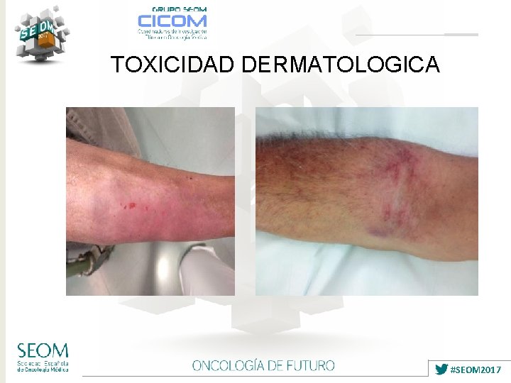 TOXICIDAD DERMATOLOGICA #SEOM 2017 