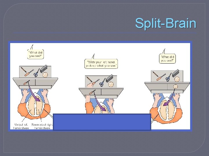 Split-Brain 