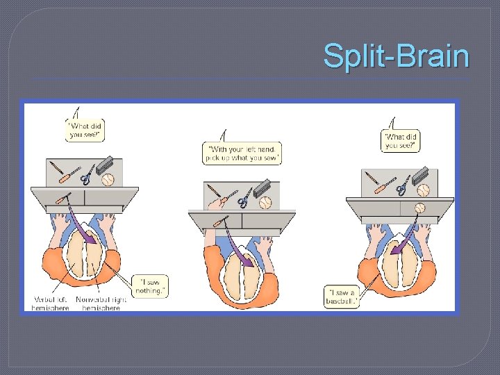 Split-Brain 
