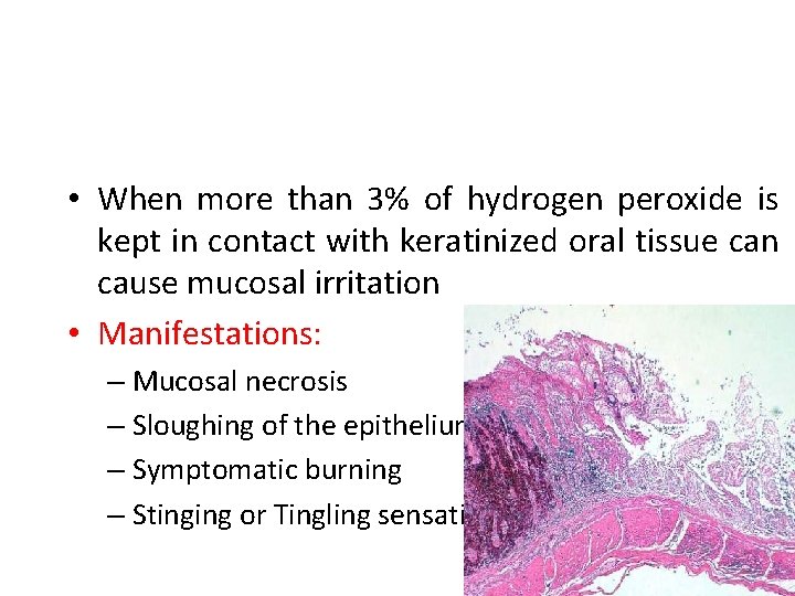  • When more than 3% of hydrogen peroxide is kept in contact with