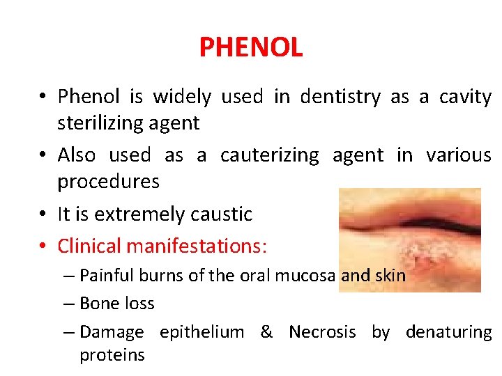 PHENOL • Phenol is widely used in dentistry as a cavity sterilizing agent •