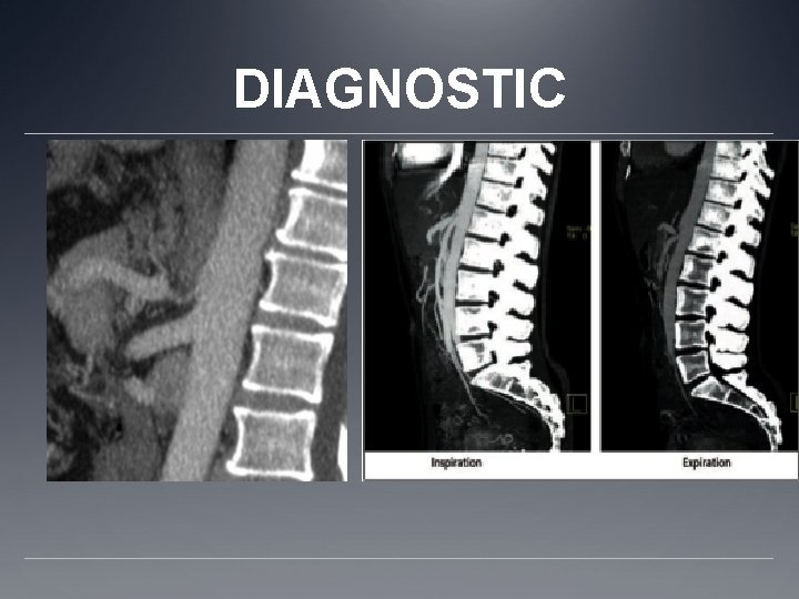 DIAGNOSTIC 