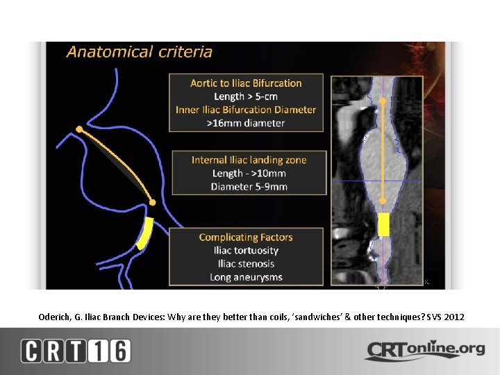 Oderich, G. Iliac Branch Devices: Why are they better than coils, ‘sandwiches’ & other