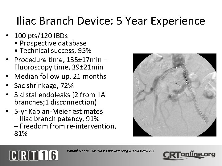 Iliac Branch Device: 5 Year Experience • 100 pts/120 IBDs • Prospective database •