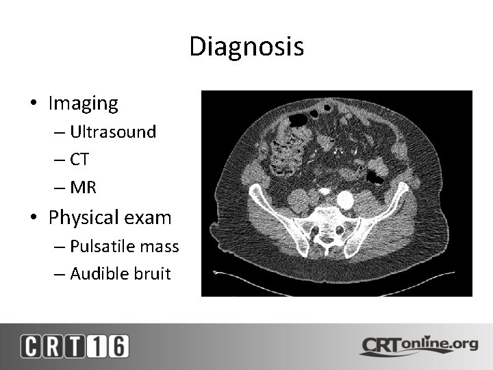 Diagnosis • Imaging – Ultrasound – CT – MR • Physical exam – Pulsatile