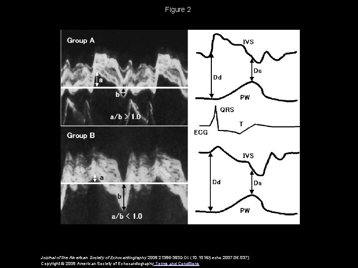 Figure 2 Journal of the American Society of Echocardiography 2008 21386 -393 DOI: (10.