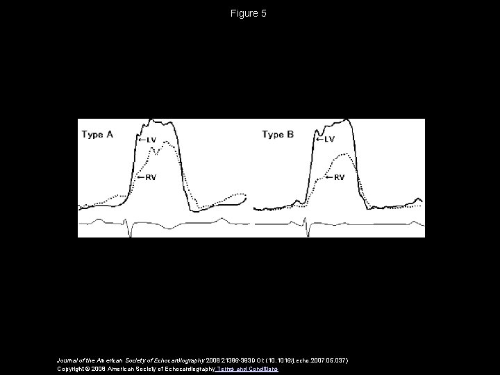 Figure 5 Journal of the American Society of Echocardiography 2008 21386 -393 DOI: (10.