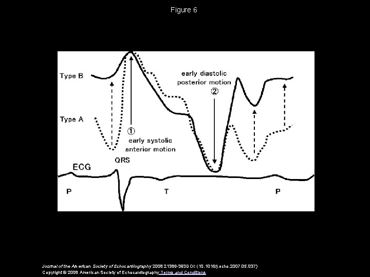 Figure 6 Journal of the American Society of Echocardiography 2008 21386 -393 DOI: (10.