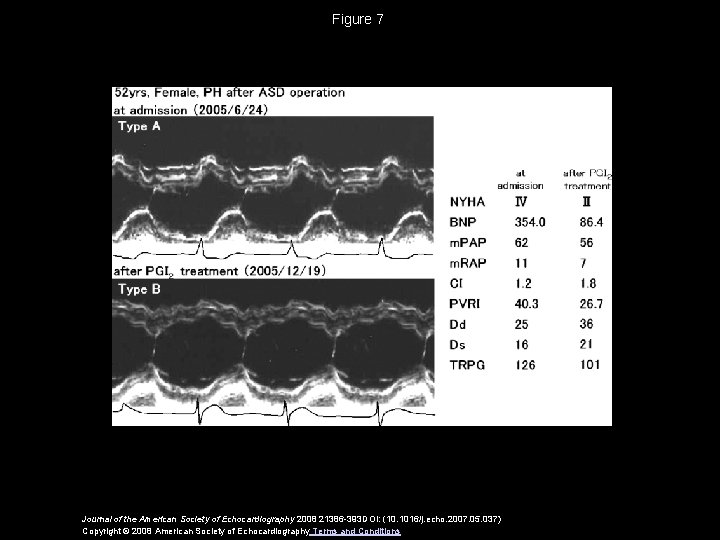 Figure 7 Journal of the American Society of Echocardiography 2008 21386 -393 DOI: (10.