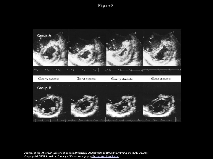 Figure 8 Journal of the American Society of Echocardiography 2008 21386 -393 DOI: (10.