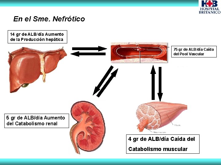 En el Sme. Nefrótico 14 gr de ALB/día Aumento de la Producción hepática 75