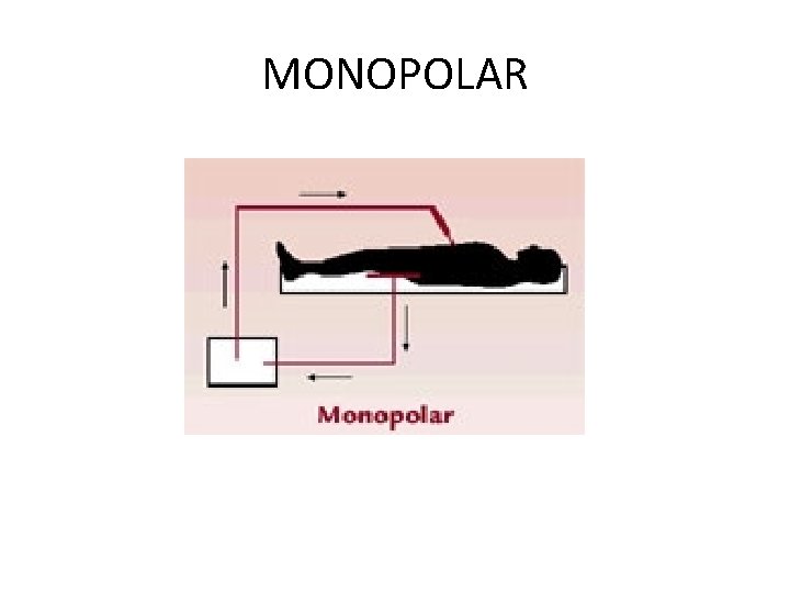 MONOPOLAR 