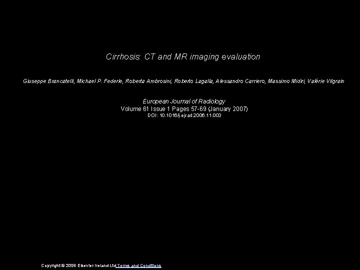 Cirrhosis: CT and MR imaging evaluation Giuseppe Brancatelli, Michael P. Federle, Roberta Ambrosini, Roberto