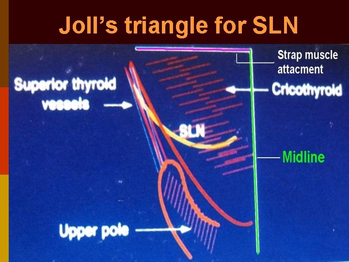 Joll’s triangle for SLN 