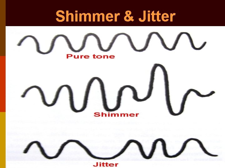 Shimmer & Jitter 